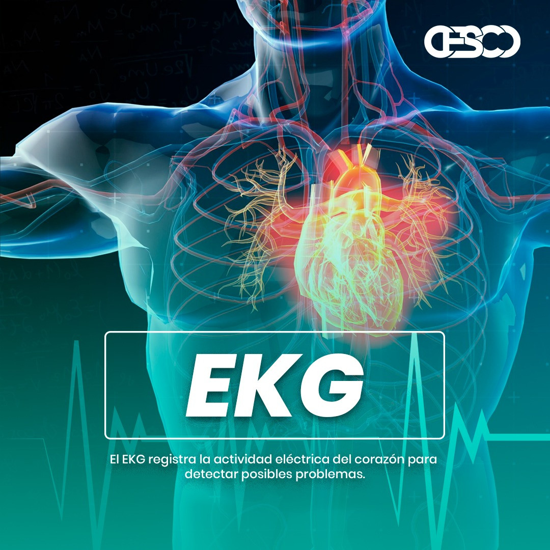 EKG
